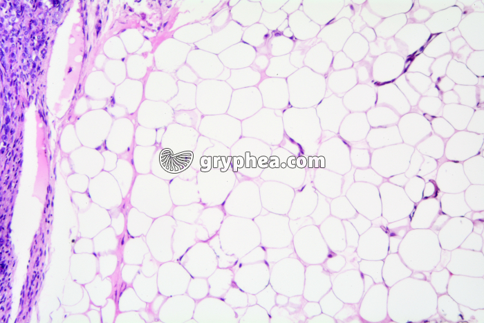 Tissu adipeux - Ovaire de Lapine x40 - gryphea.com